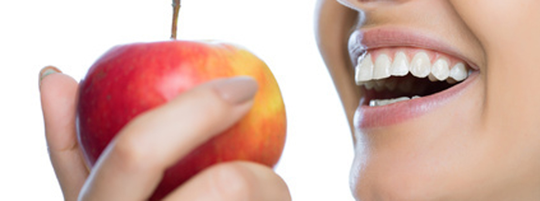 Weiße Zähne und Apfel